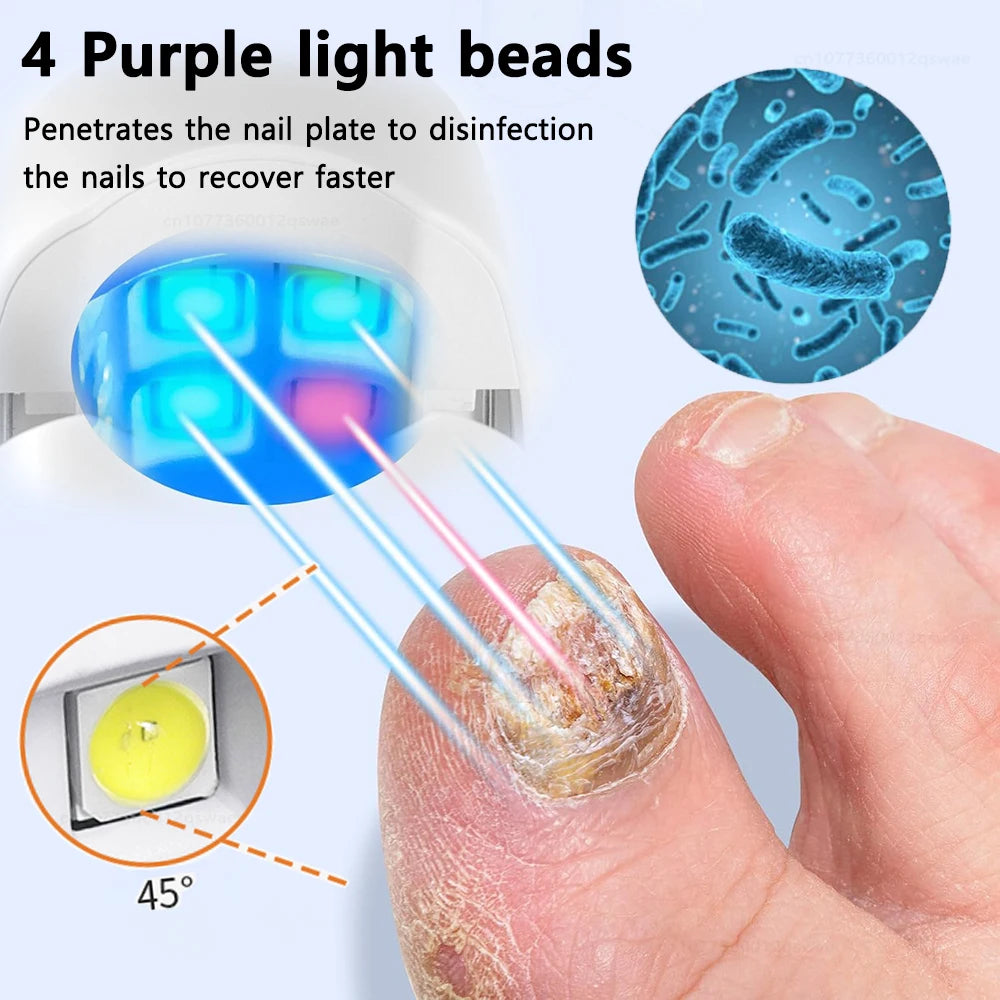 Nail Fungus Cleaning Light Device Onychomycosis