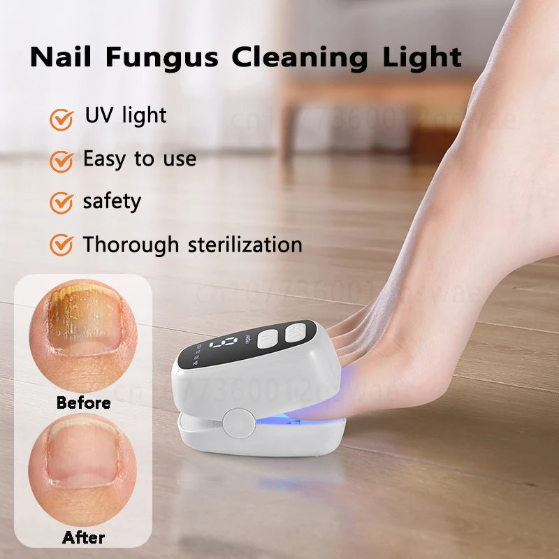 Nail Fungus Cleaning Light Device Onychomycosis