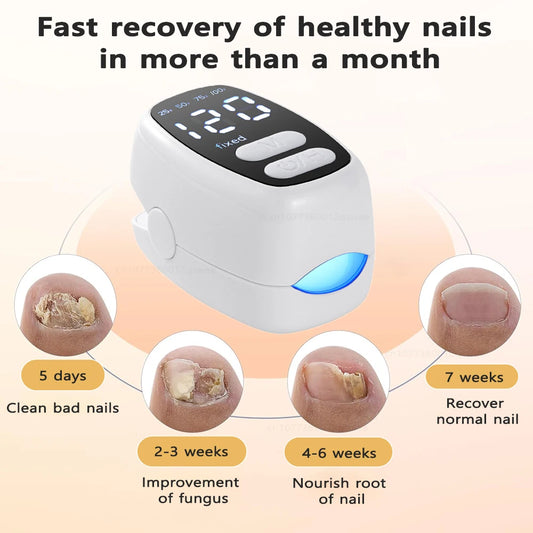 Nail Fungus Cleaning Light Device Onychomycosis