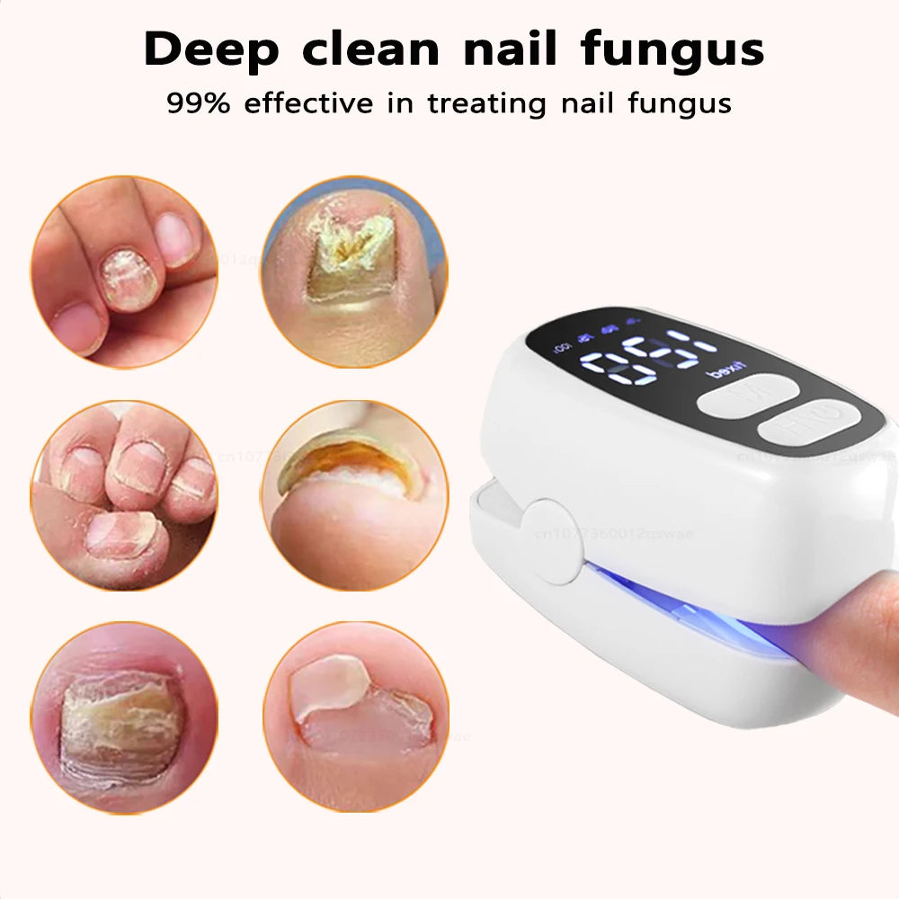 Nail Fungus Cleaning Light Device Onychomycosis